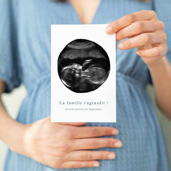 une photo recadrée d'une femme enceinte après une échographie