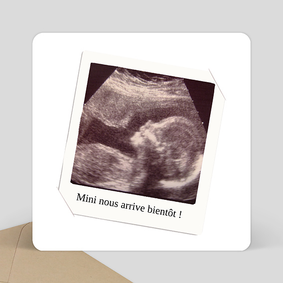 Cadre d'échographie, cadre photo d'annonce de bébé, cadeau de